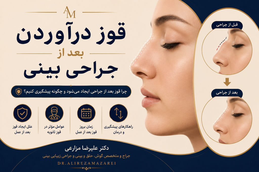 قوز بینی بعد از عمل و علت ایجاد برآمدگی روی بینی بعد از جراحی